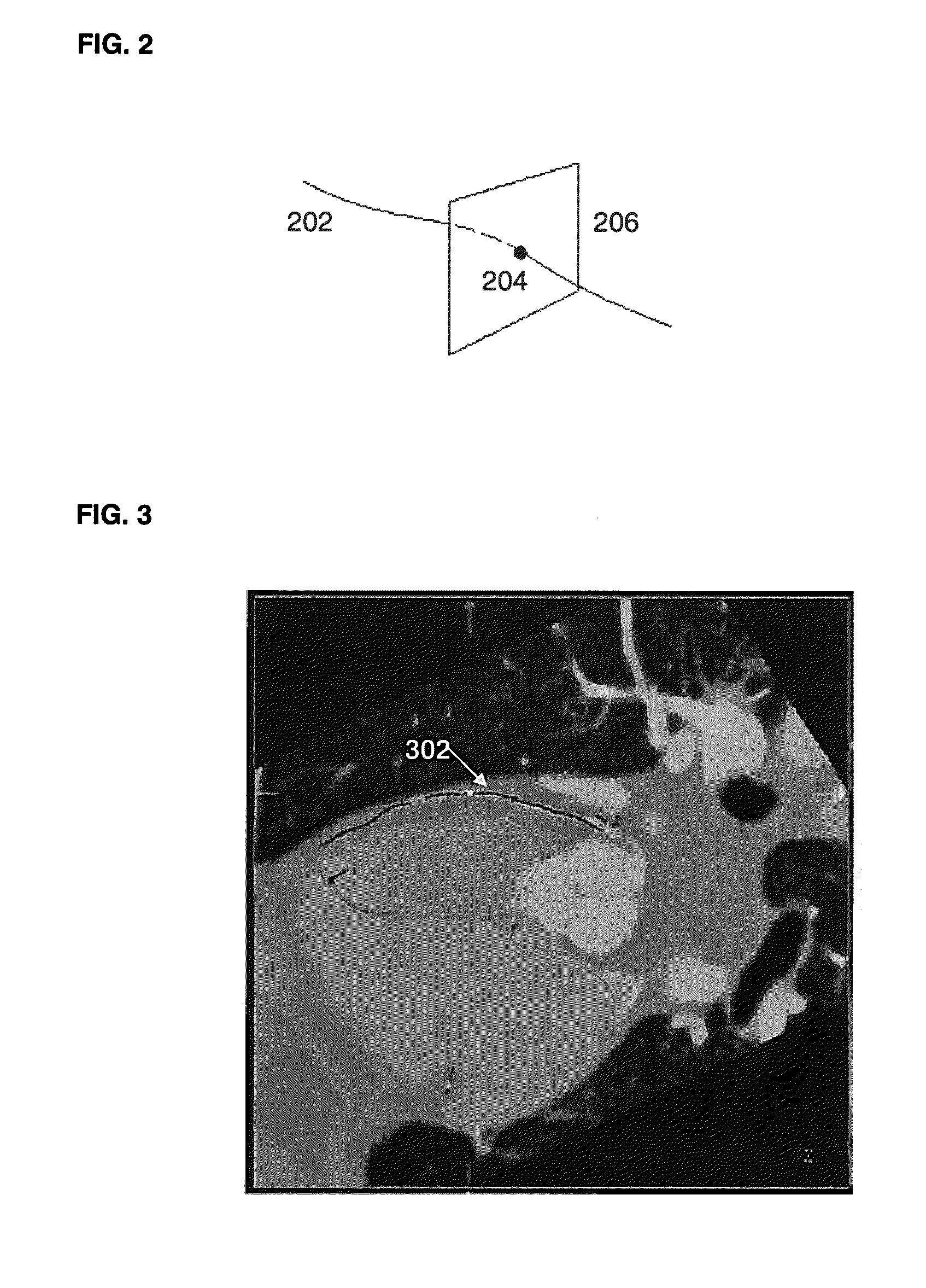 Method and System for Automatic Coronary Artery Detection