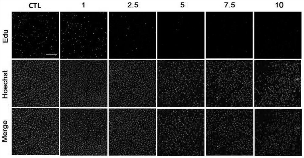 A kind of berberine linoleic acid conjugate and its preparation method and application