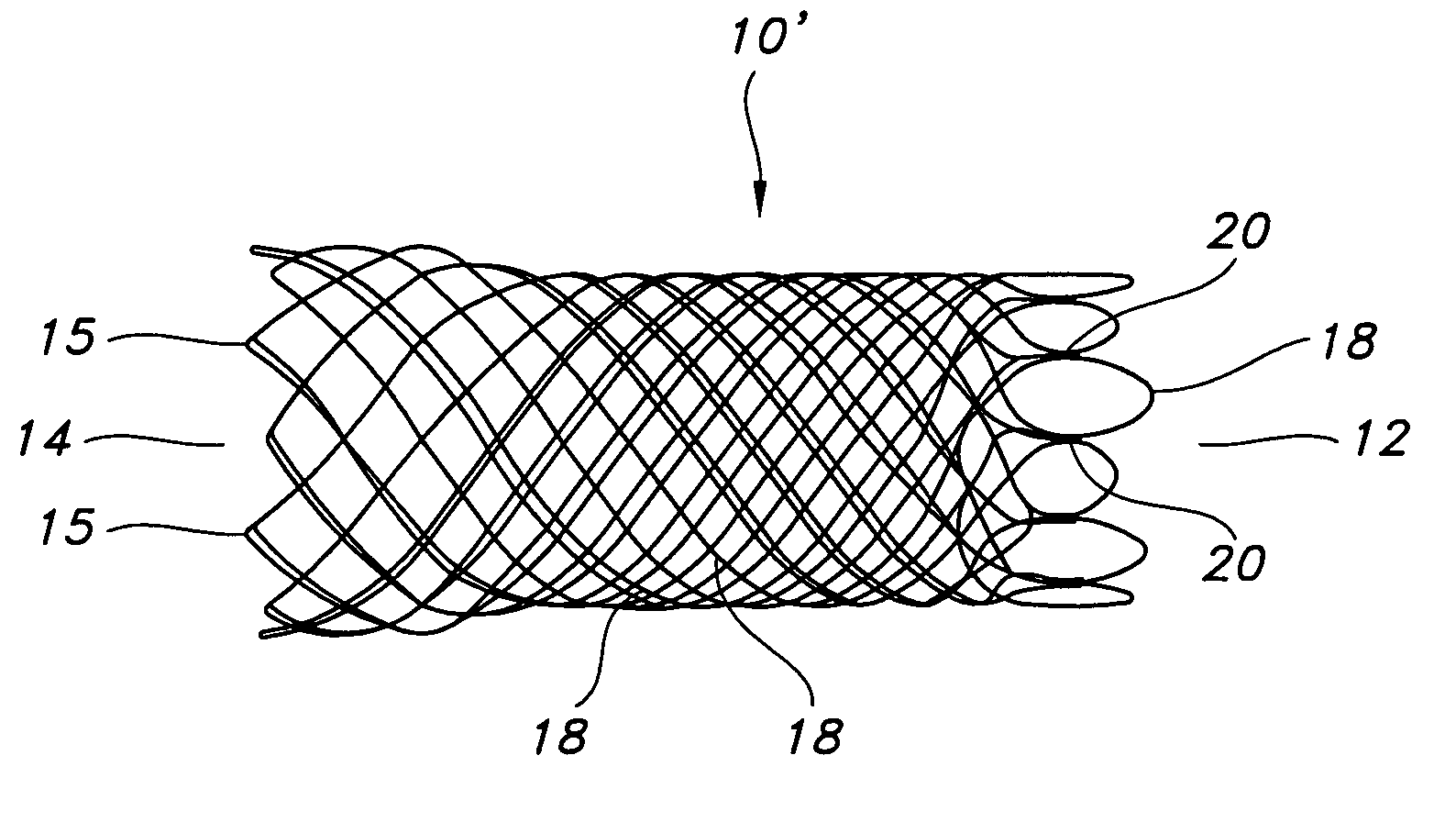 Atraumatic stent with reduced deployment force, method for making the same and method and apparatus for deploying and positioning the stent