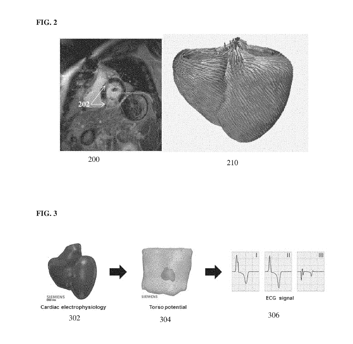 System and method for patient-specific image-based guidance of cardiac arrhythmia therapies