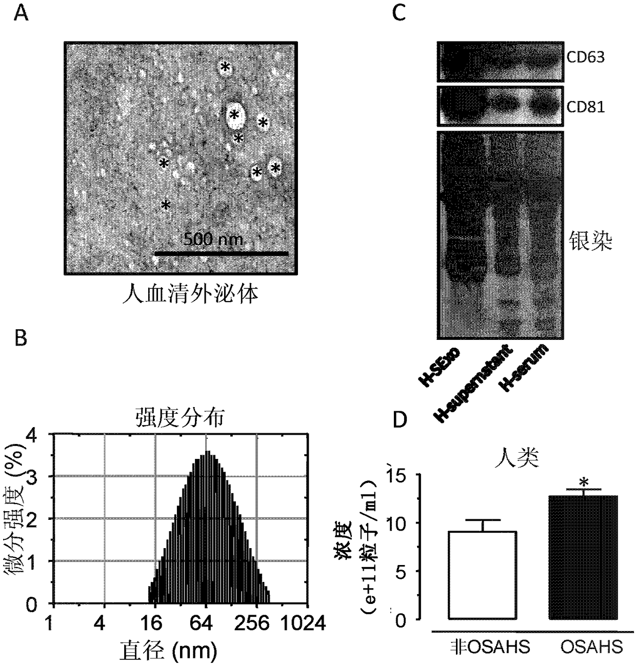 Serum exosome protein marker for obstructive sleep apnea-hypopnea syndrome and application thereof