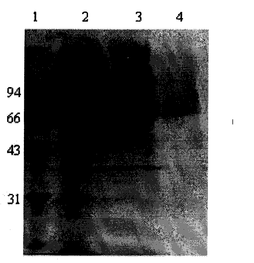 Acidophil Beta-glucanase GLU7A and gene and application thereof