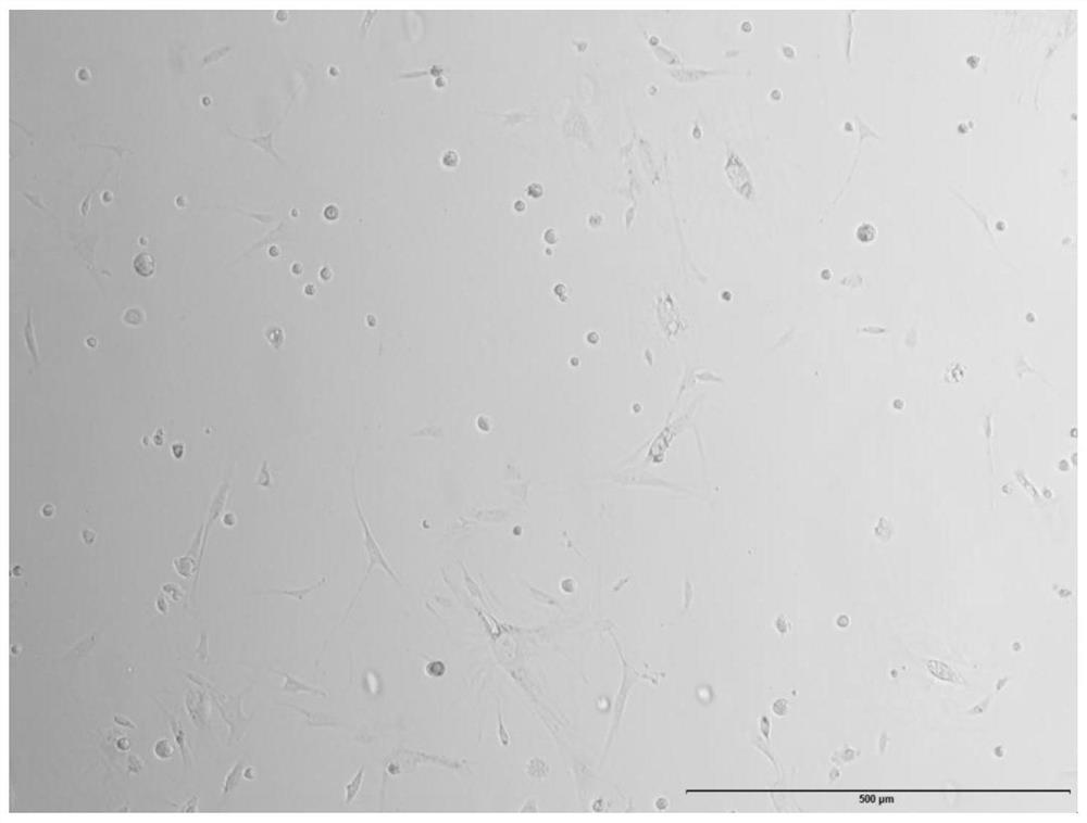 Mouse ovary primary cell culture medium and in-vitro culture method capable of being applied to gene editing