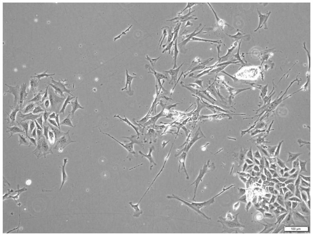 Mouse ovary primary cell culture medium and in-vitro culture method capable of being applied to gene editing