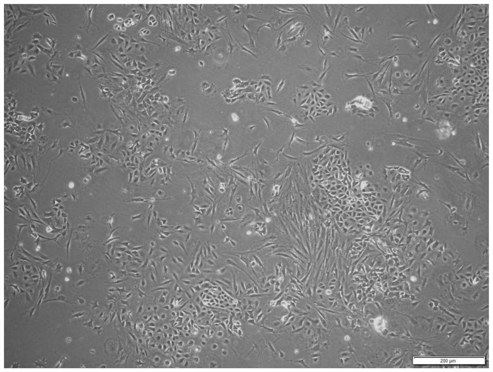 Mouse ovary primary cell culture medium and in-vitro culture method capable of being applied to gene editing