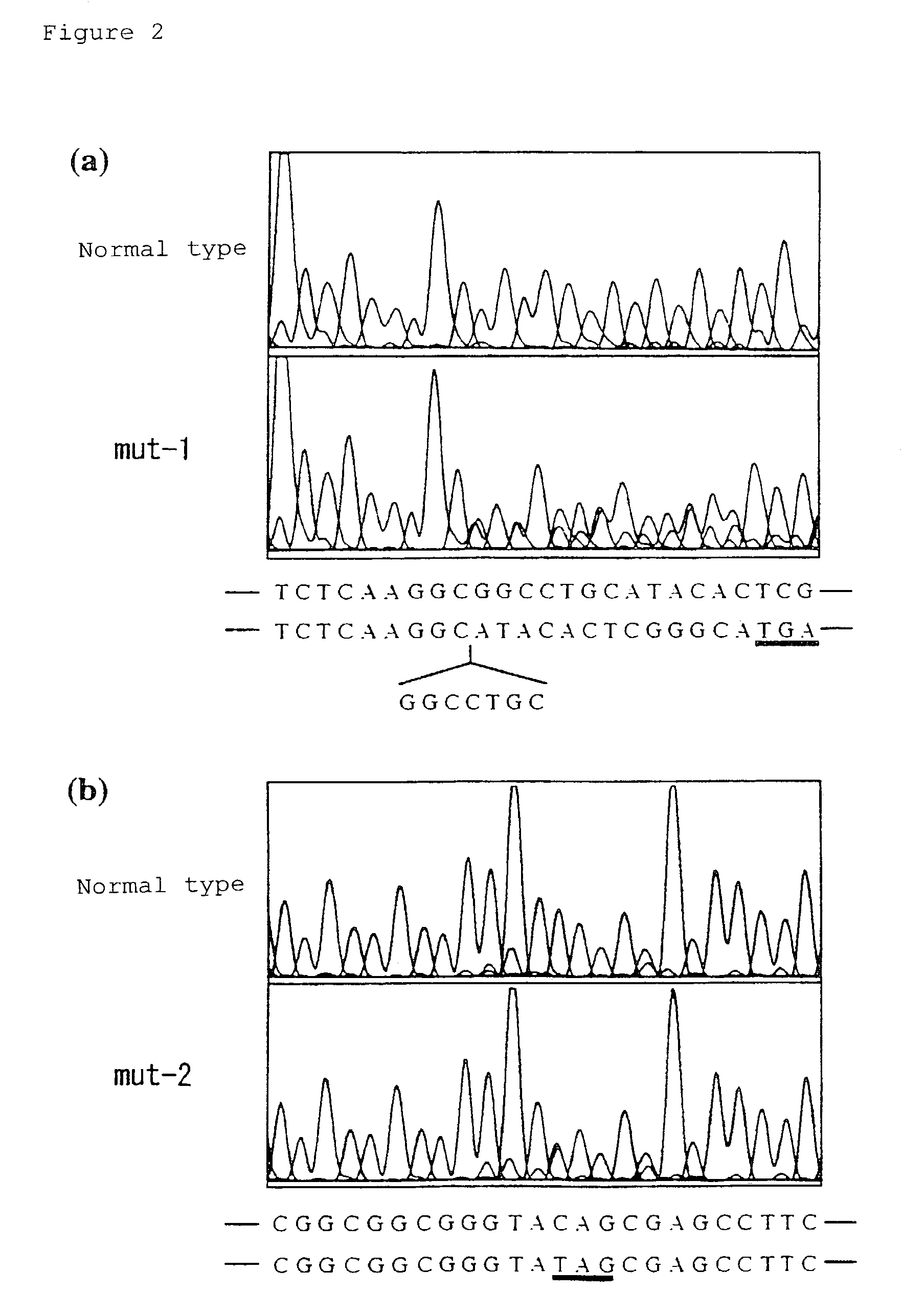 Gene causative of Rothmund-Thomson syndrome and gene product