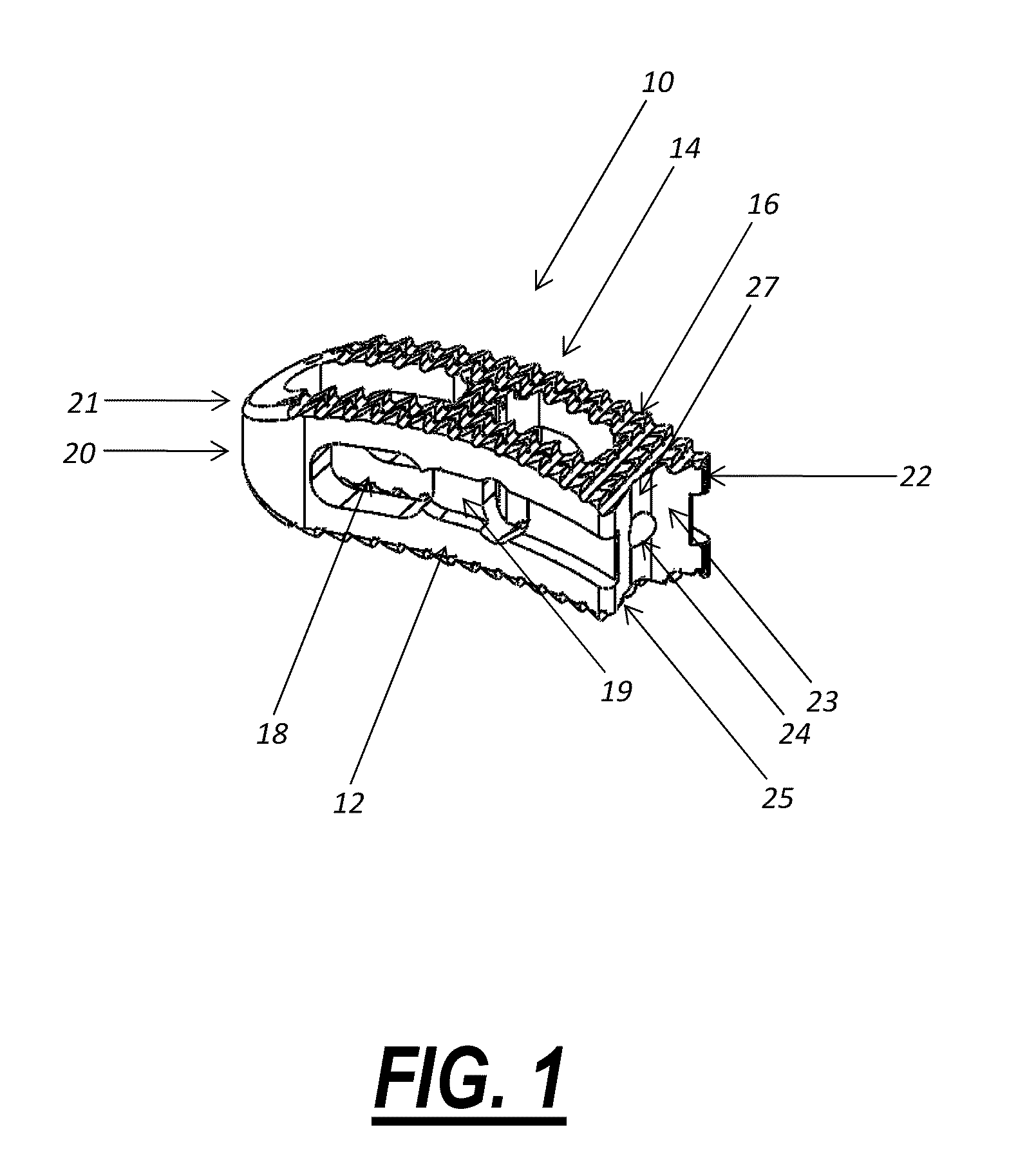 Intervertebral implant device for a posterior interbody fusion surgical procedure