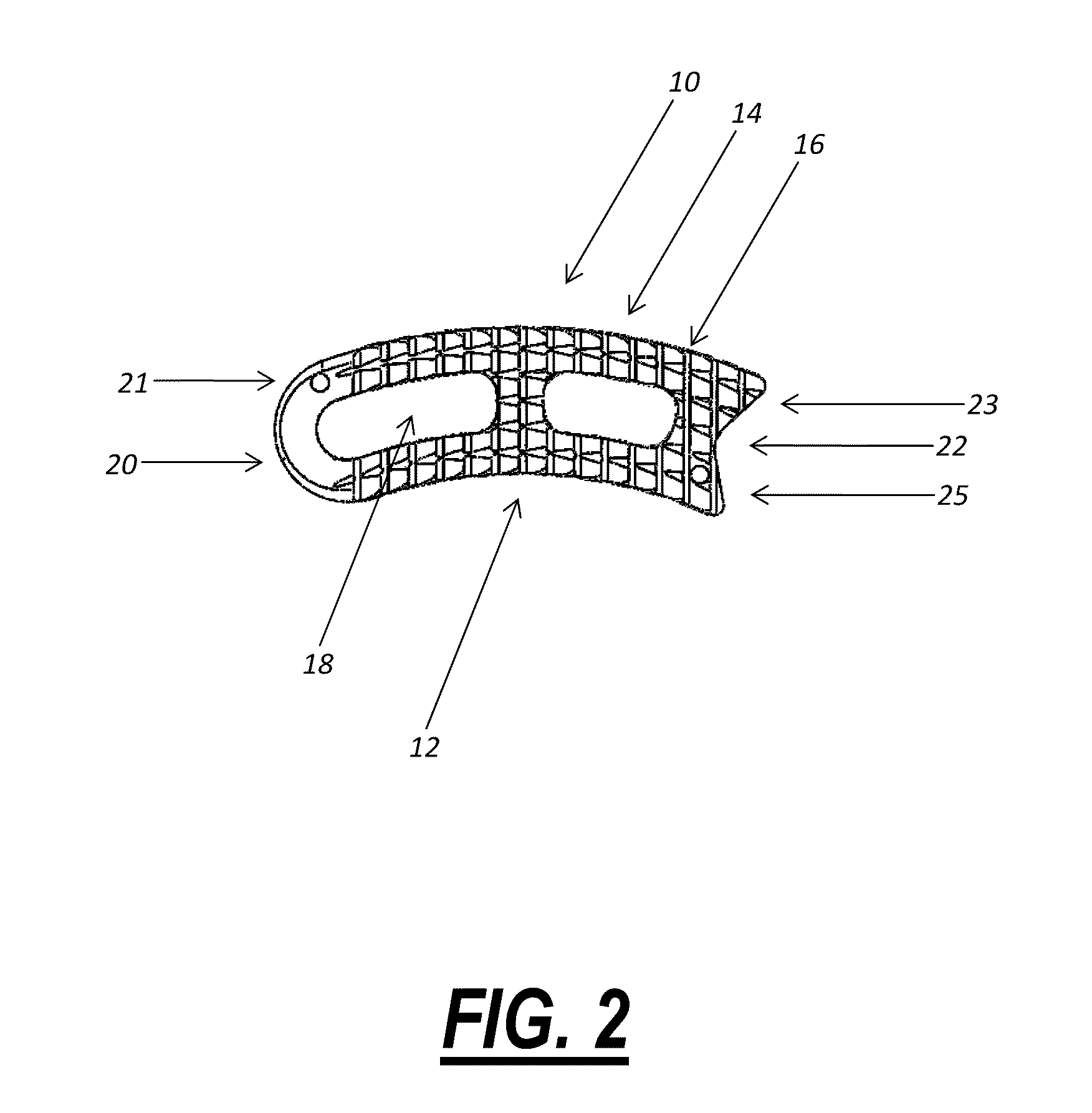 Intervertebral implant device for a posterior interbody fusion surgical procedure