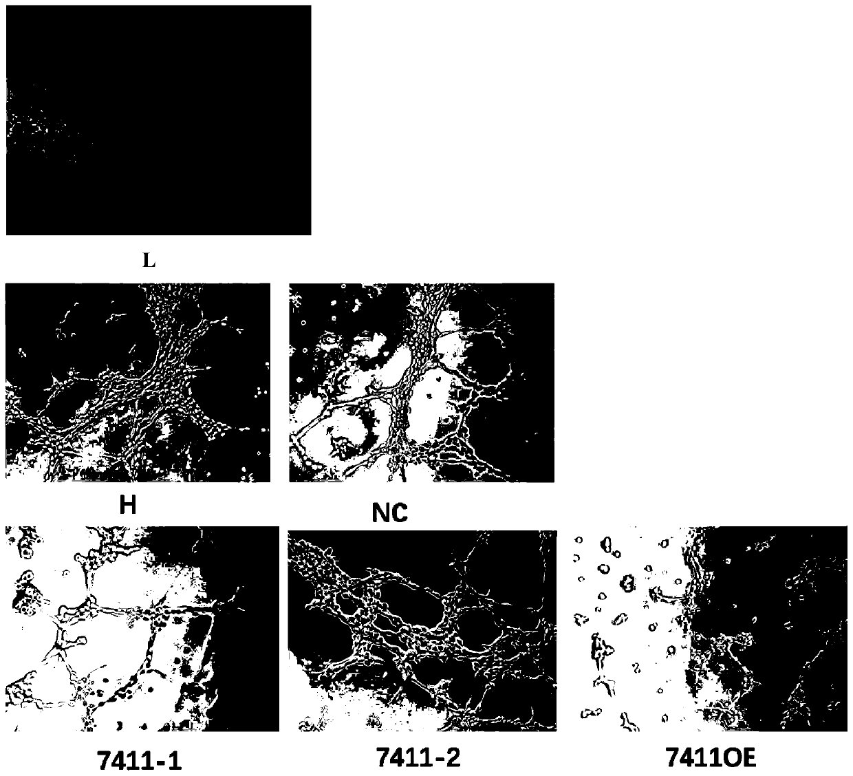 A kind of circRNA inhibits the application in the field of angiogenesis