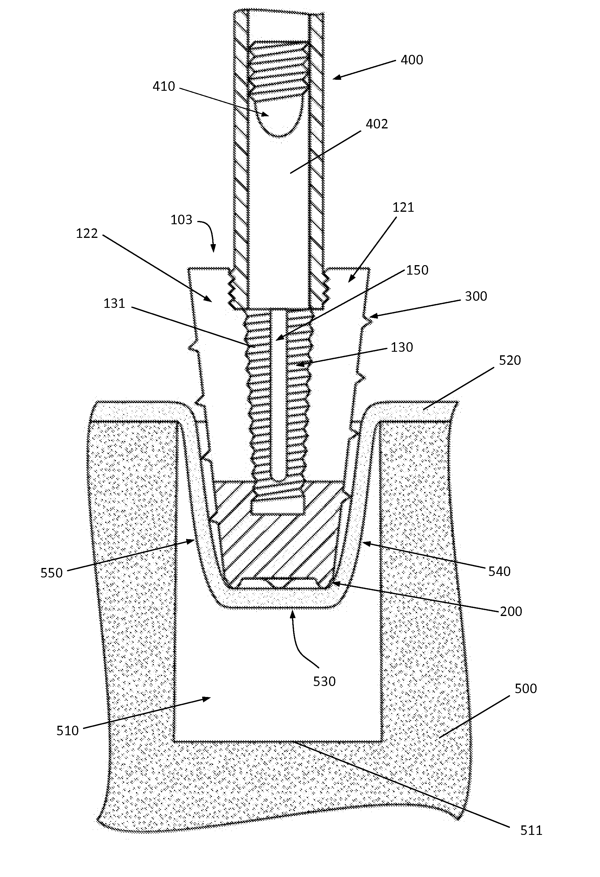 Device and method for anchoring soft tissue to bone