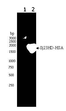 Schistosoma japonicum 23kDa membrane protein big hydrophilic peptide segment fusion protein and application thereof in schistosome infection immune diagnosis