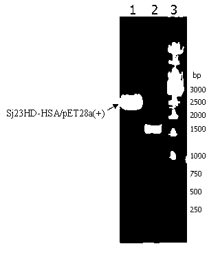 Schistosoma japonicum 23kDa membrane protein big hydrophilic peptide segment fusion protein and application thereof in schistosome infection immune diagnosis