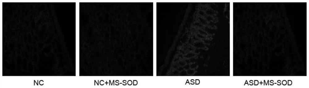 Application and products of manganese-type high-stable superoxide dismutase in improving autism