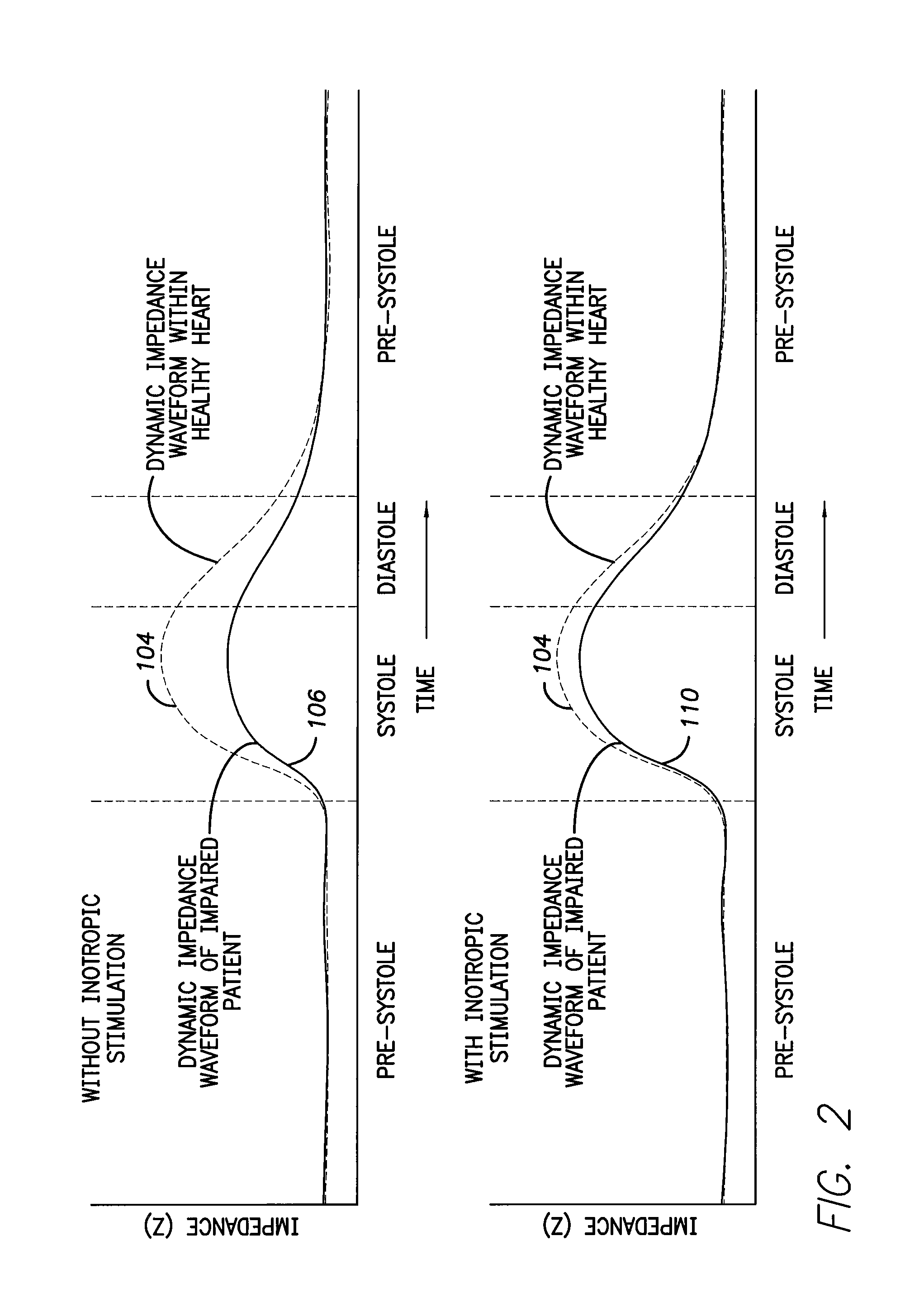 Systems and methods for delivering stimulation pulses using an implantable cardiac stimulation device