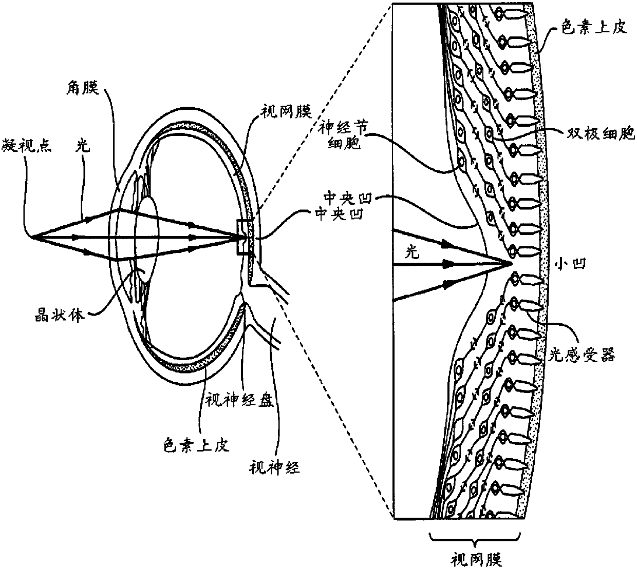 Compositions and methods for reducing visual loss