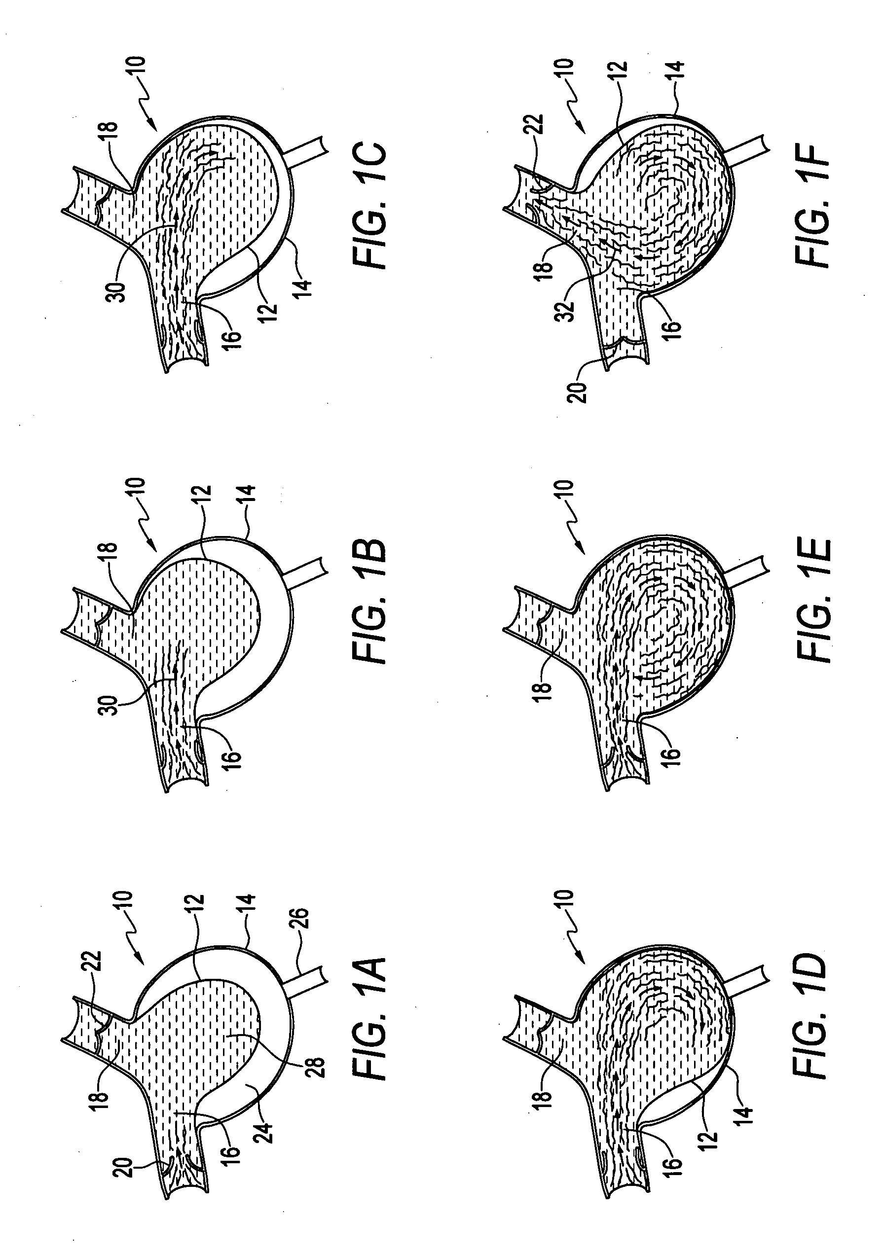 Method for making a blood pump and pumping blood