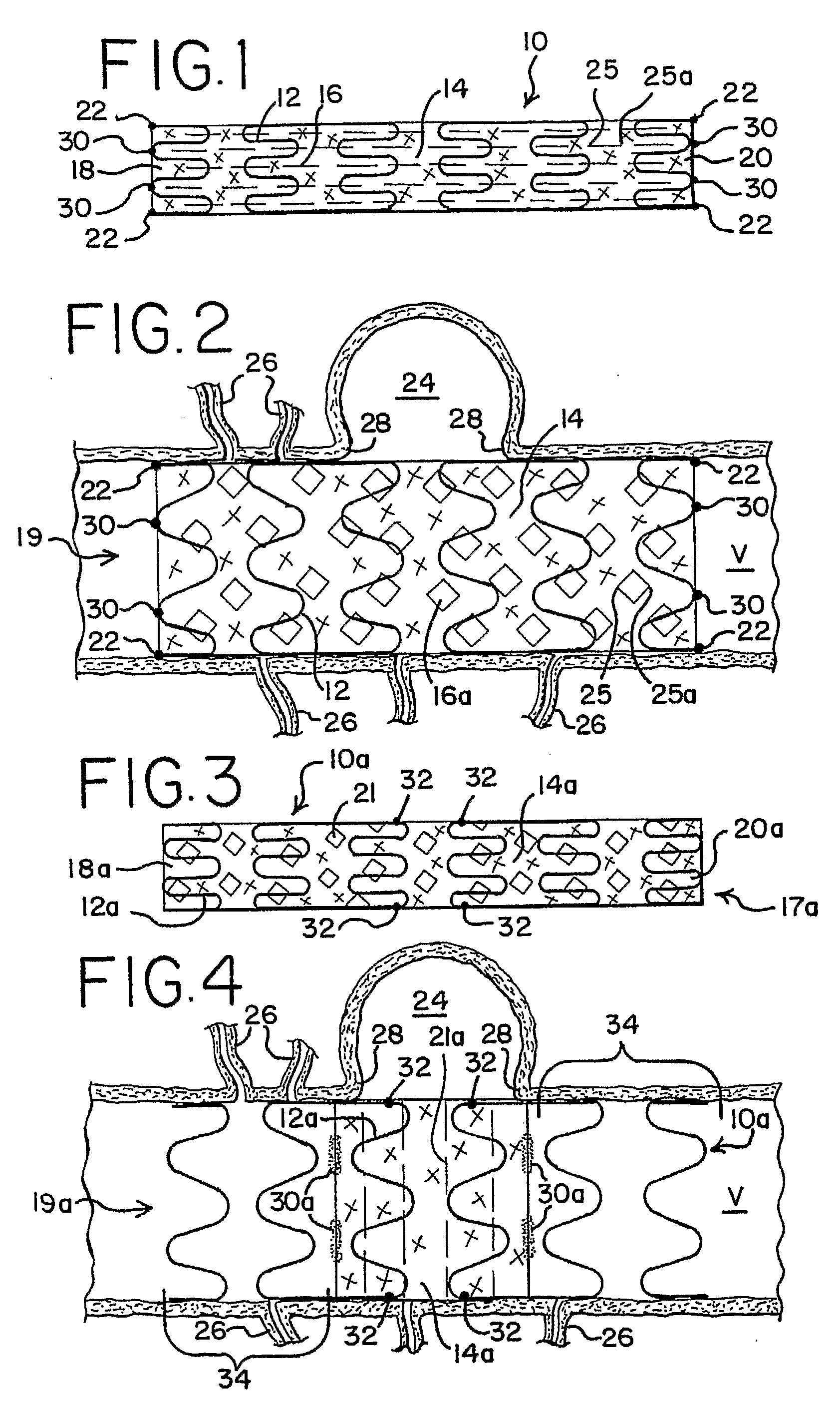Thin Film Devices for Occlusion of a Vessel