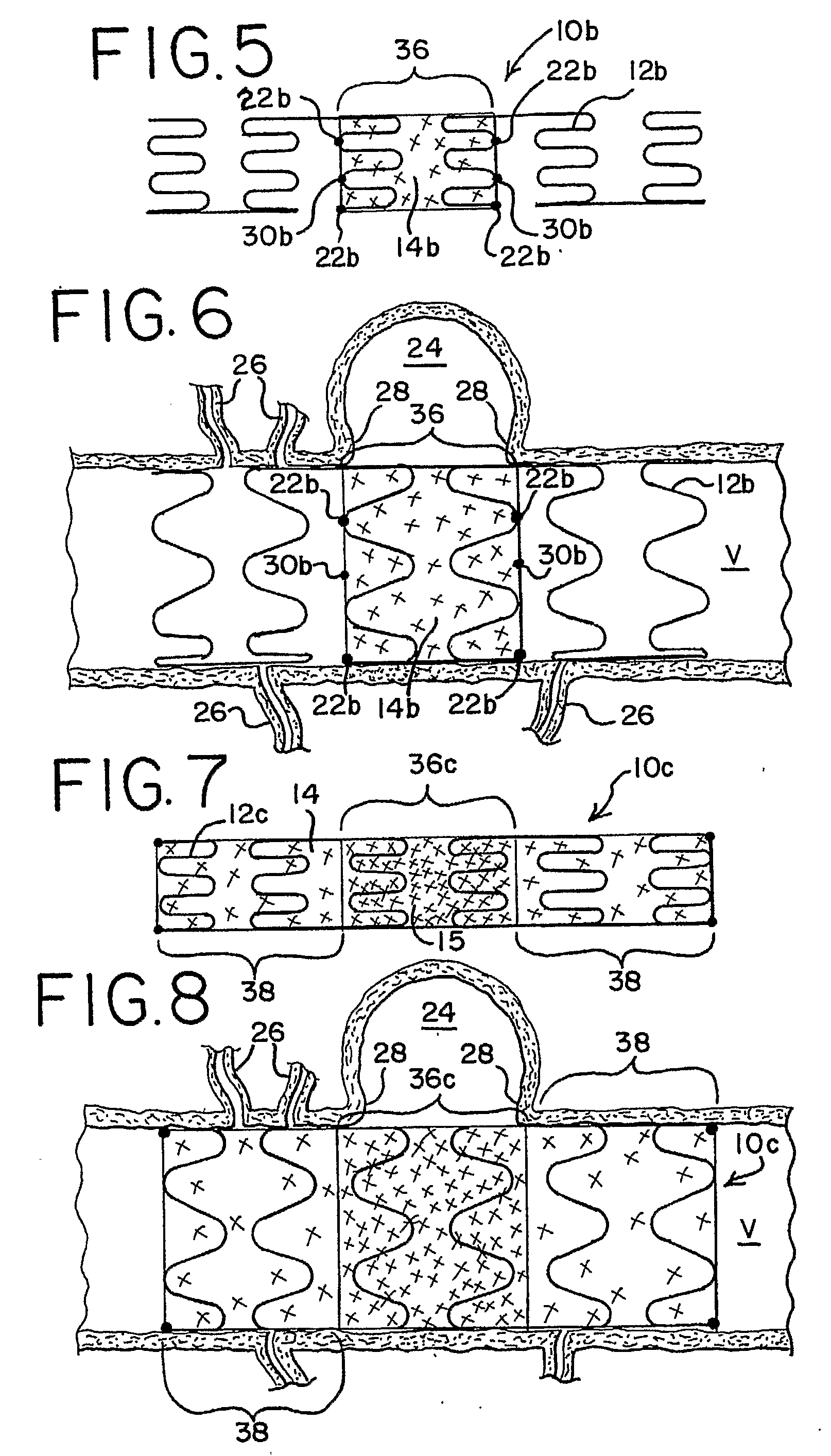 Thin Film Devices for Occlusion of a Vessel