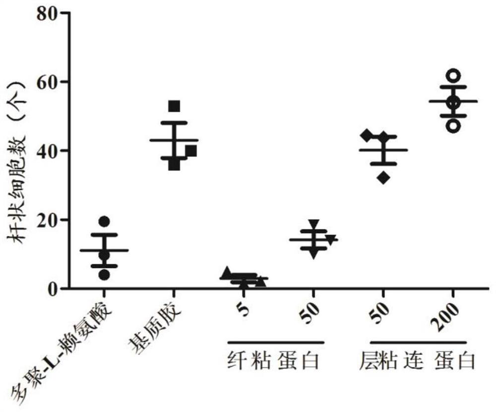 Human myocardial cell separation reagent, culture medium and separation and culture methods