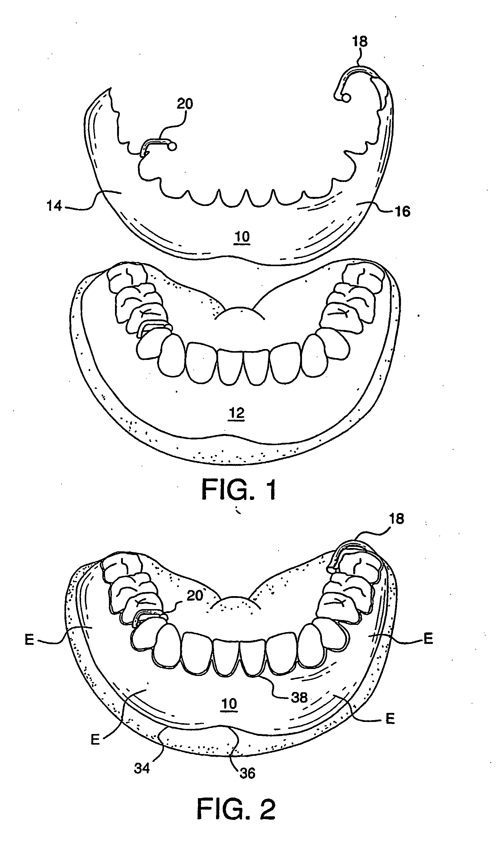 Cosmetic prosthesis and methods for making the same