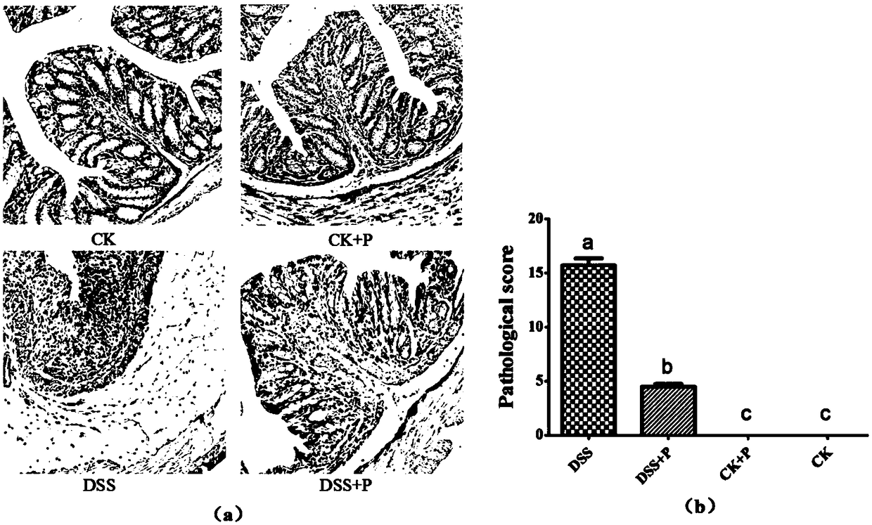 Application of phloretin to preparation of colitis preventing and treating drug
