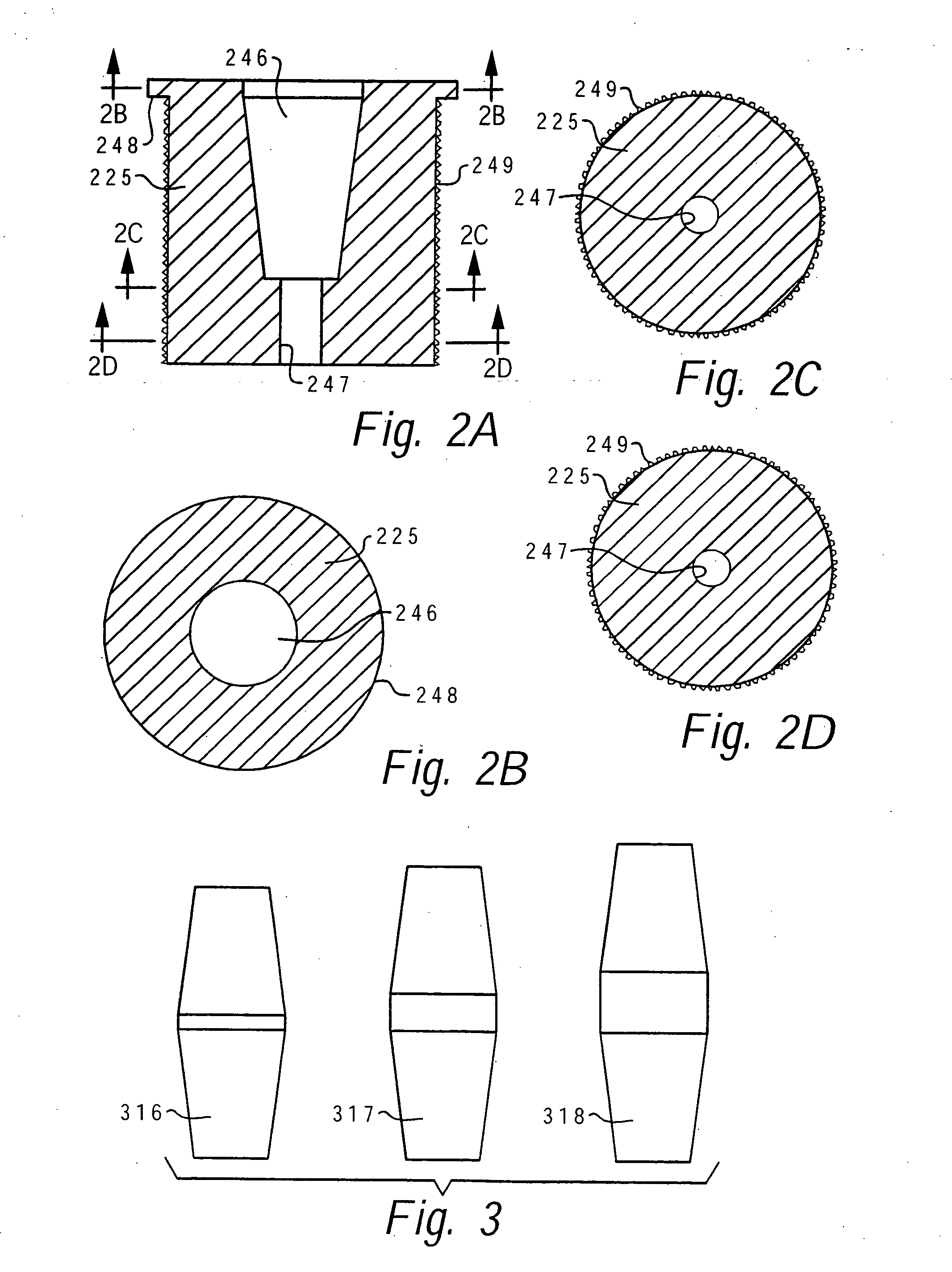 Method of implanting a femoral neck fixation prosthesis