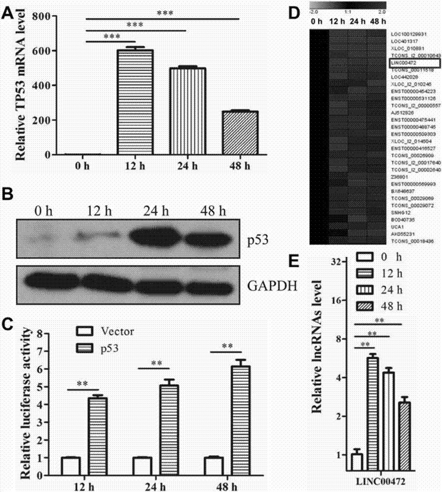 Expression vector of long-chain non-coding RNALINC00472, tumor suppression reagent and application thereof