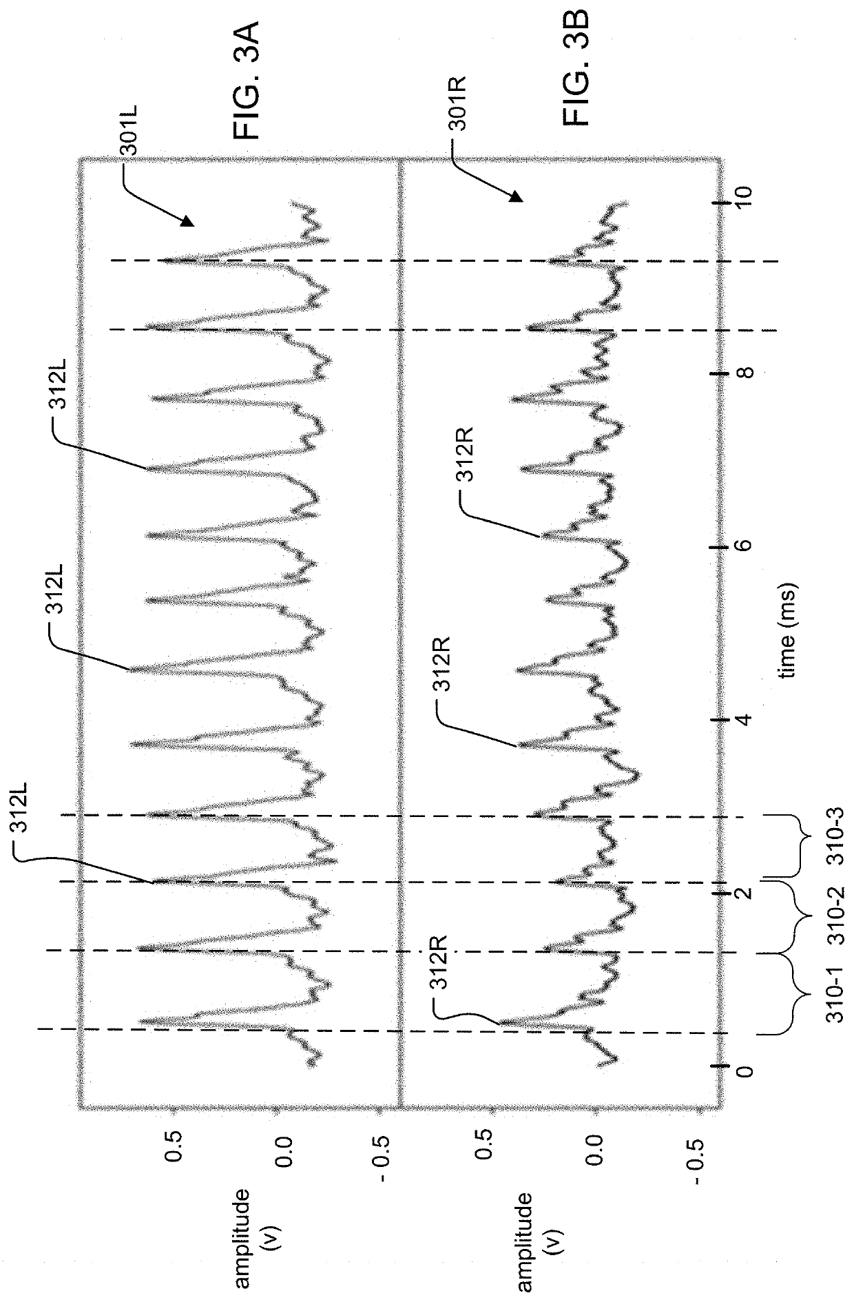 System and Method for Noninvasive Monitoring, Diagnosis and Reporting of Cardiovascular Stenosis
