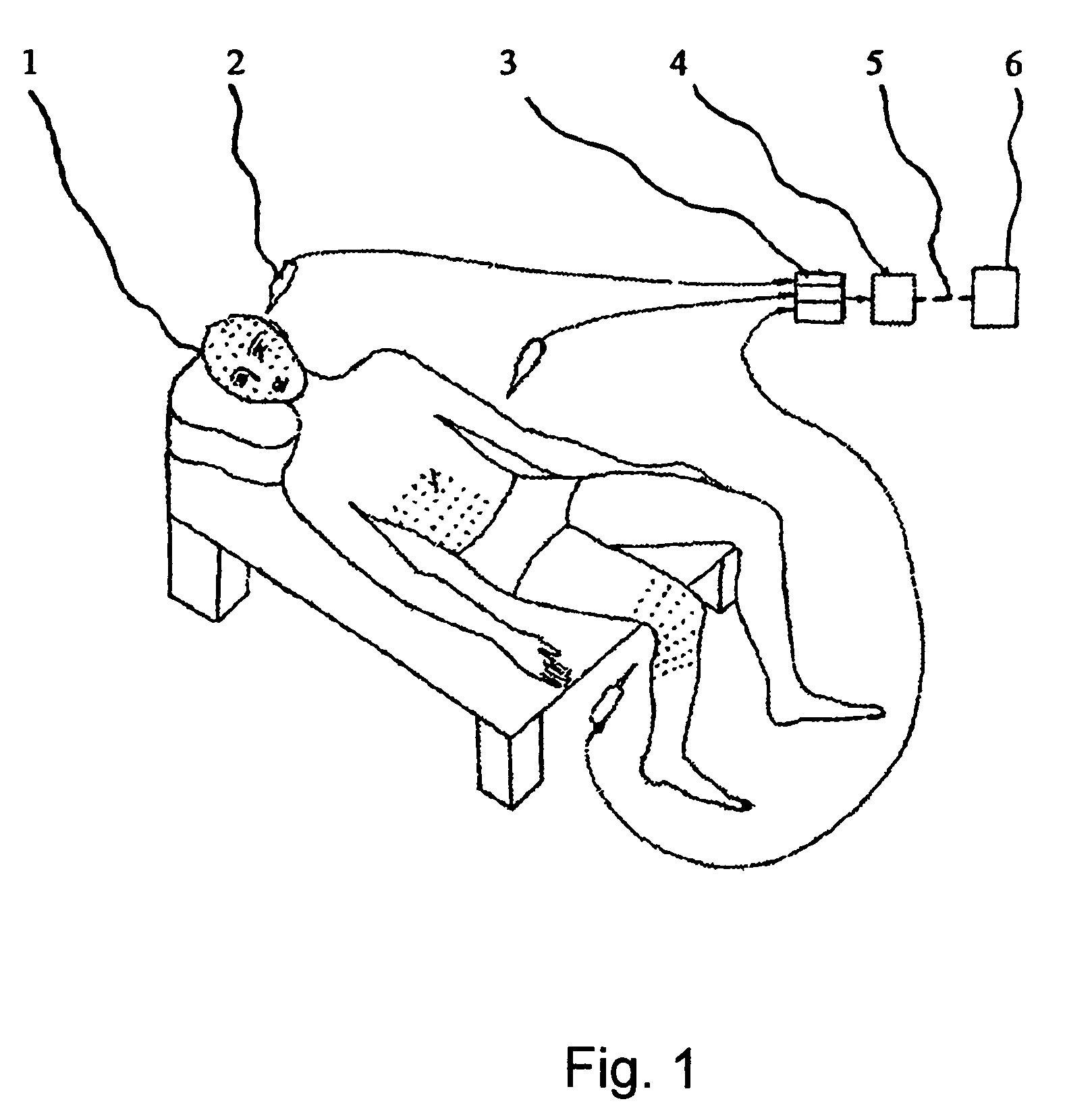 Method for thermal diagnosis of pathology of a bioobject and device for carrying out said method
