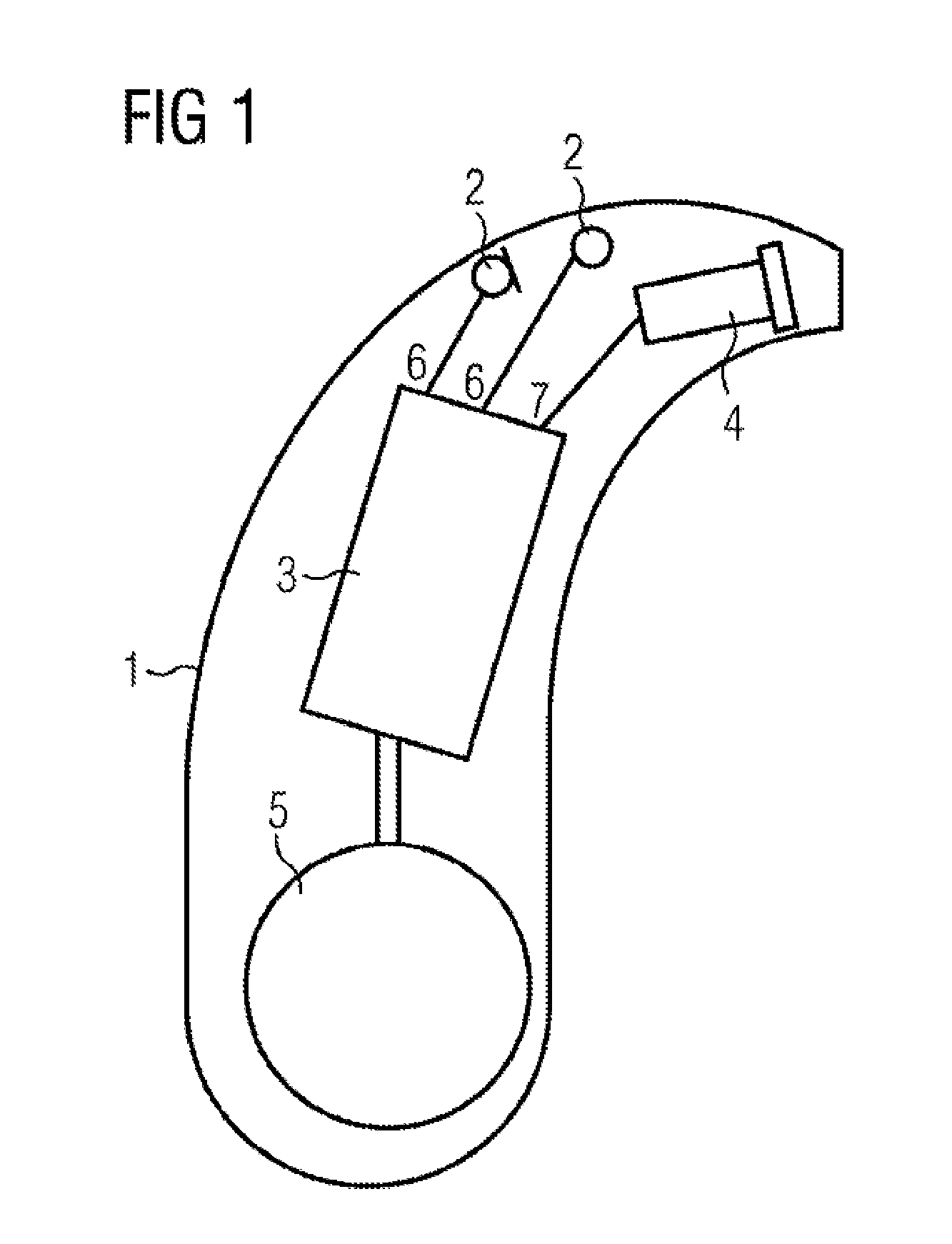 Method and device for reducing acoustic feedback