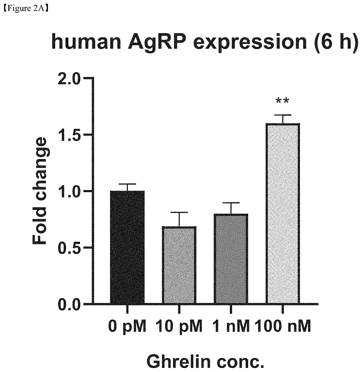 Producing method of mesenchymal stem cell for prevention or treatment of brain neuronal disease including ghrelin treatment and use thereof