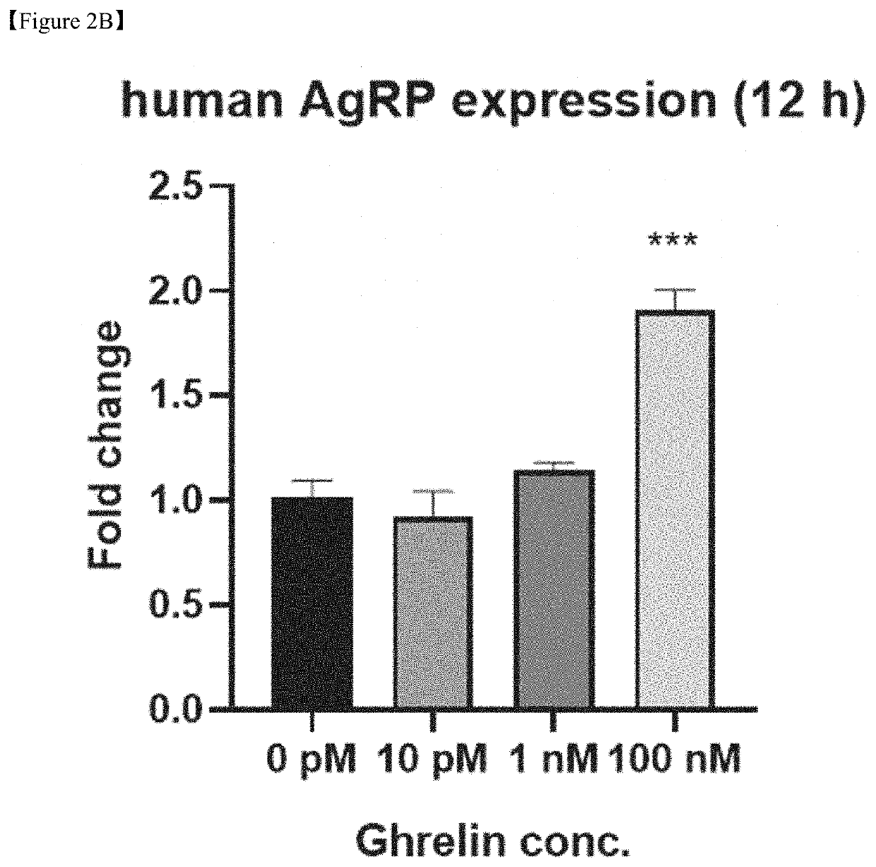 Producing method of mesenchymal stem cell for prevention or treatment of brain neuronal disease including ghrelin treatment and use thereof