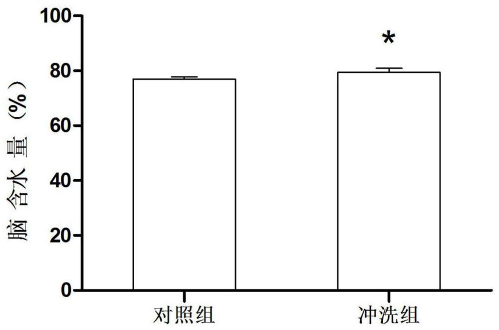 Application of Colloidal Gold in Preparation of Artificial Cerebrospinal Fluid Reagent