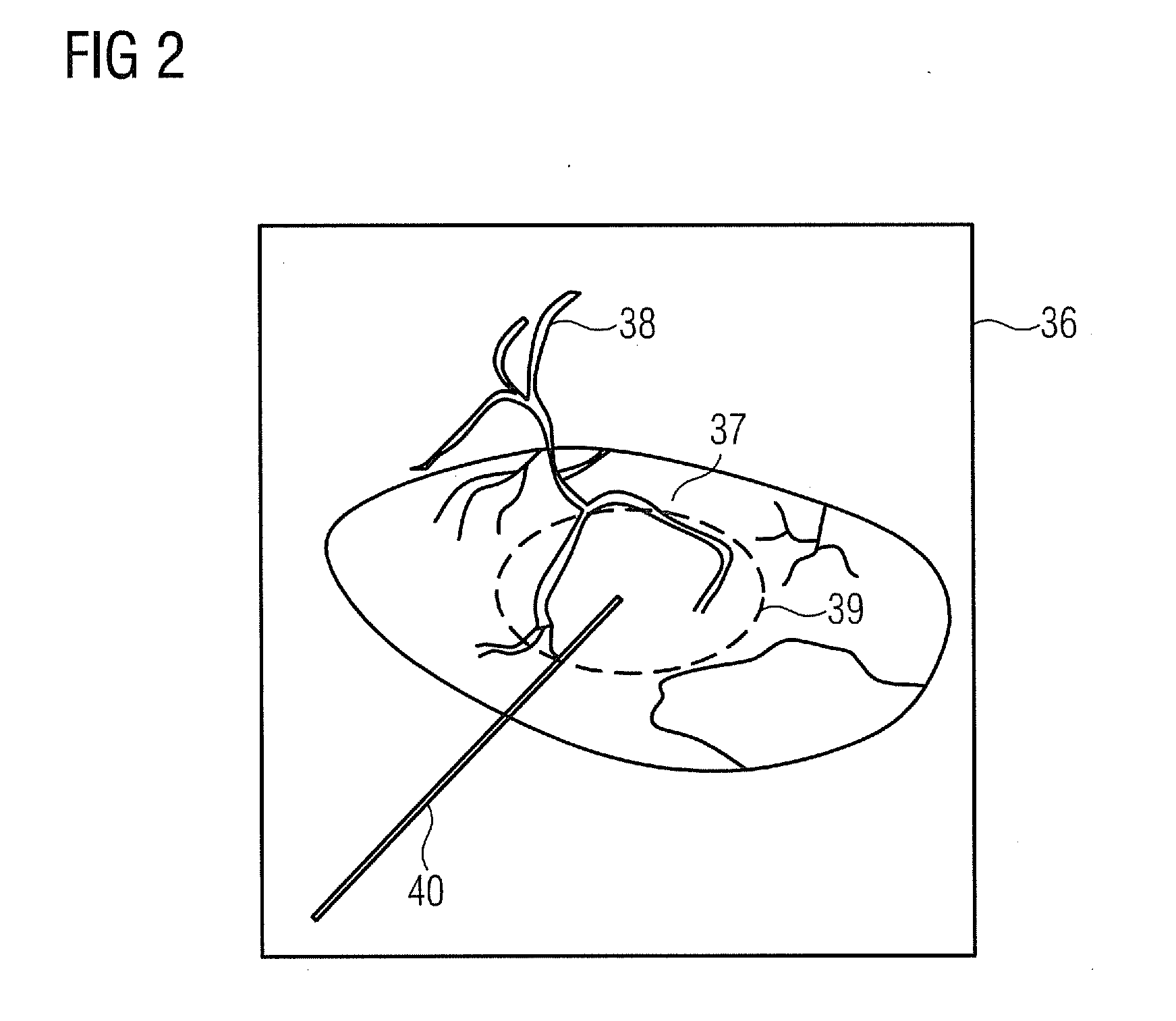 Method for positioning the focus of a gradient field and treatment facility