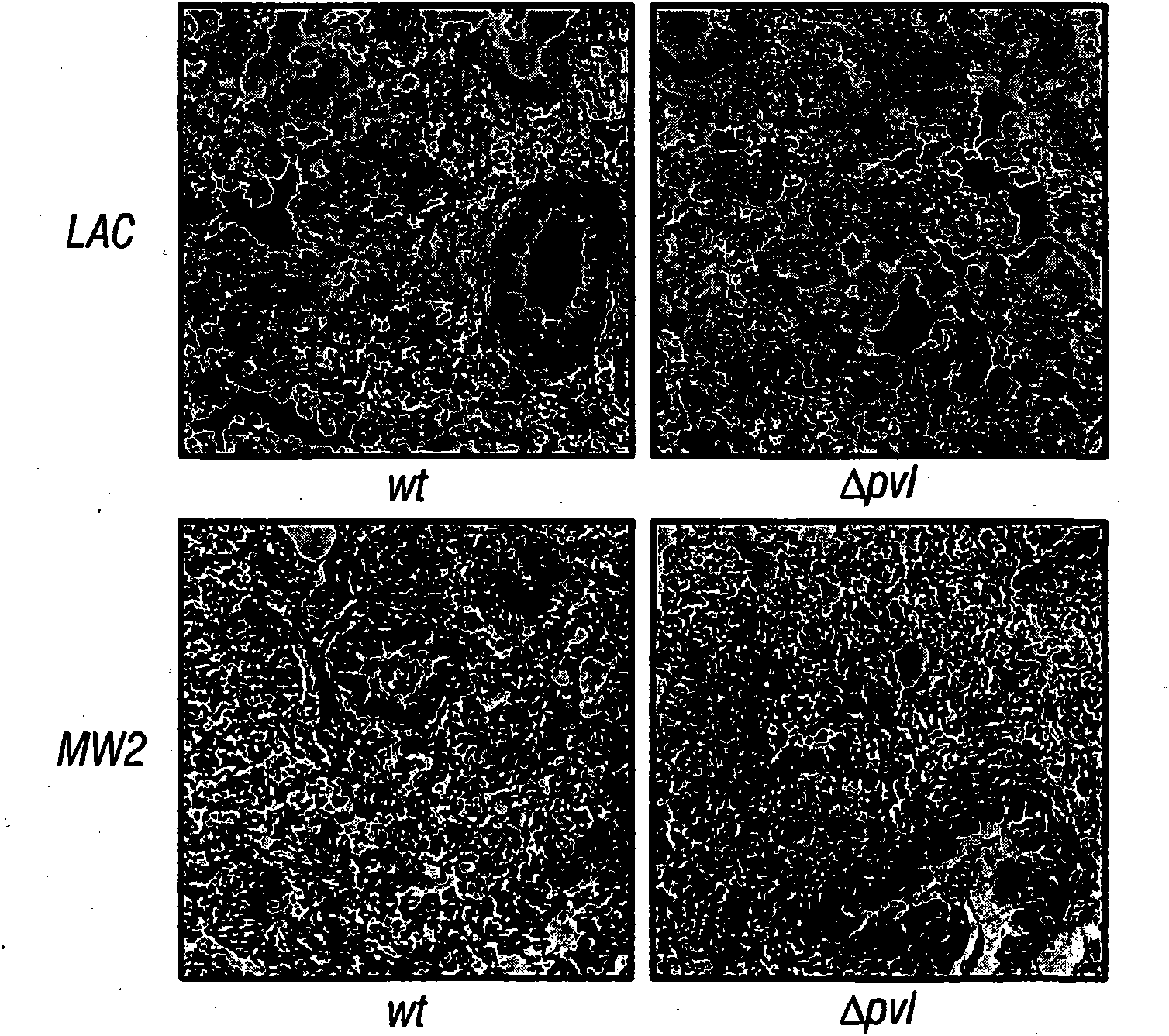 Methods and compositions related to immunizing against staphylococcal lung diseases and conditions