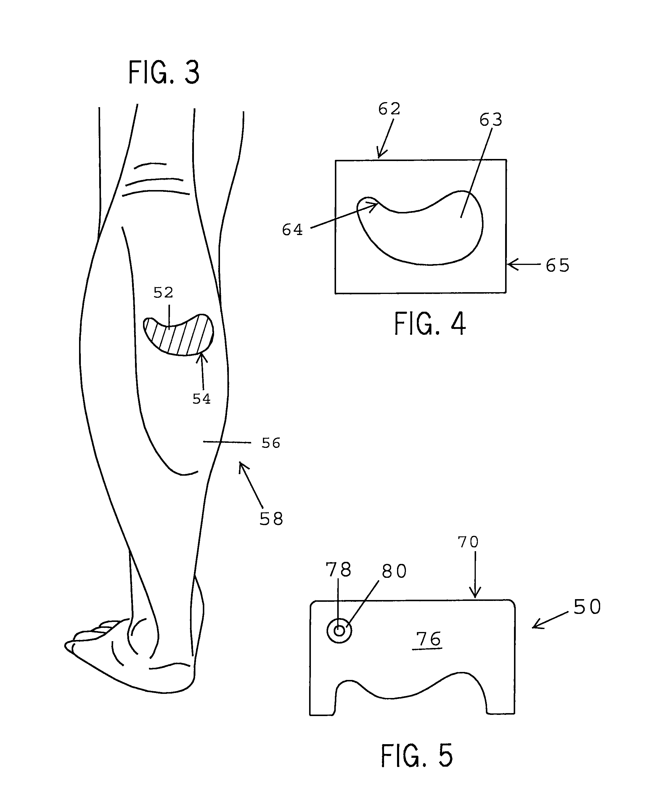 Devices and methods for manipulating circulation in the circulatory system of a patient