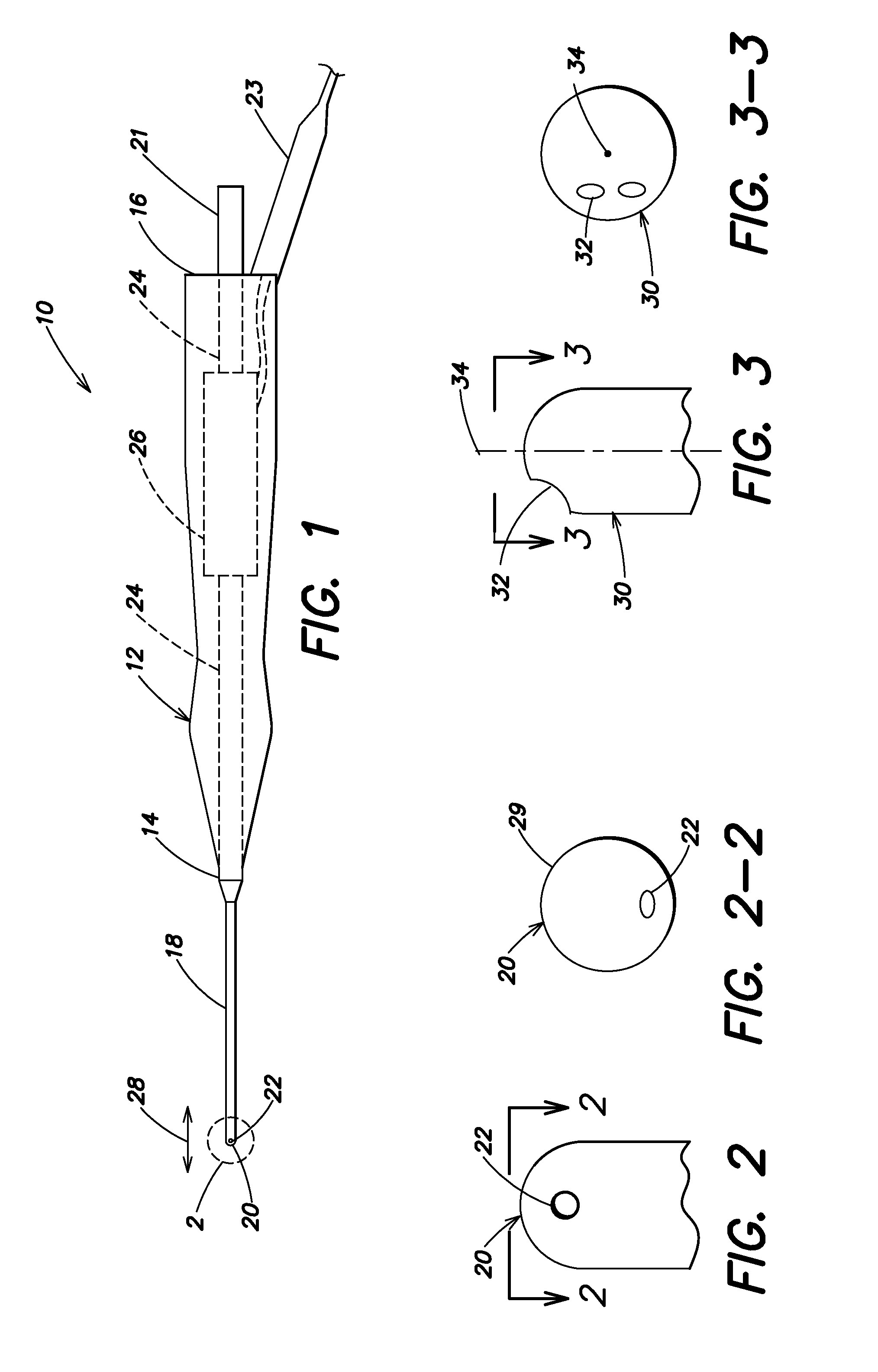 Vibrating Surgical Device for Removal of Vitreous and Other Tissue