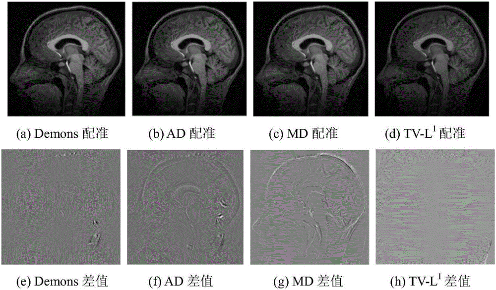 Non-rigid image registration method based on image feature and Demons