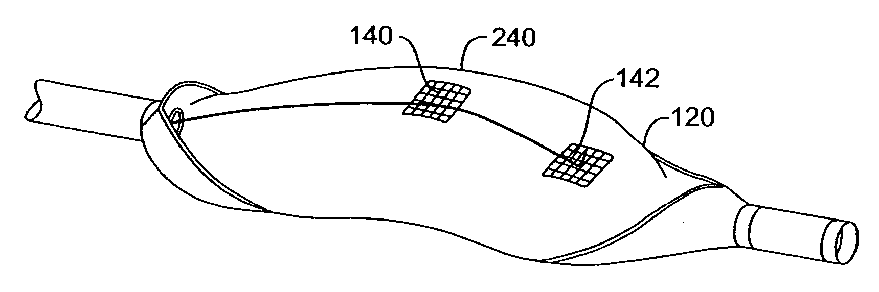 Methods and kits for delivering pharmaceutical agents into the coronary vascular adventitia