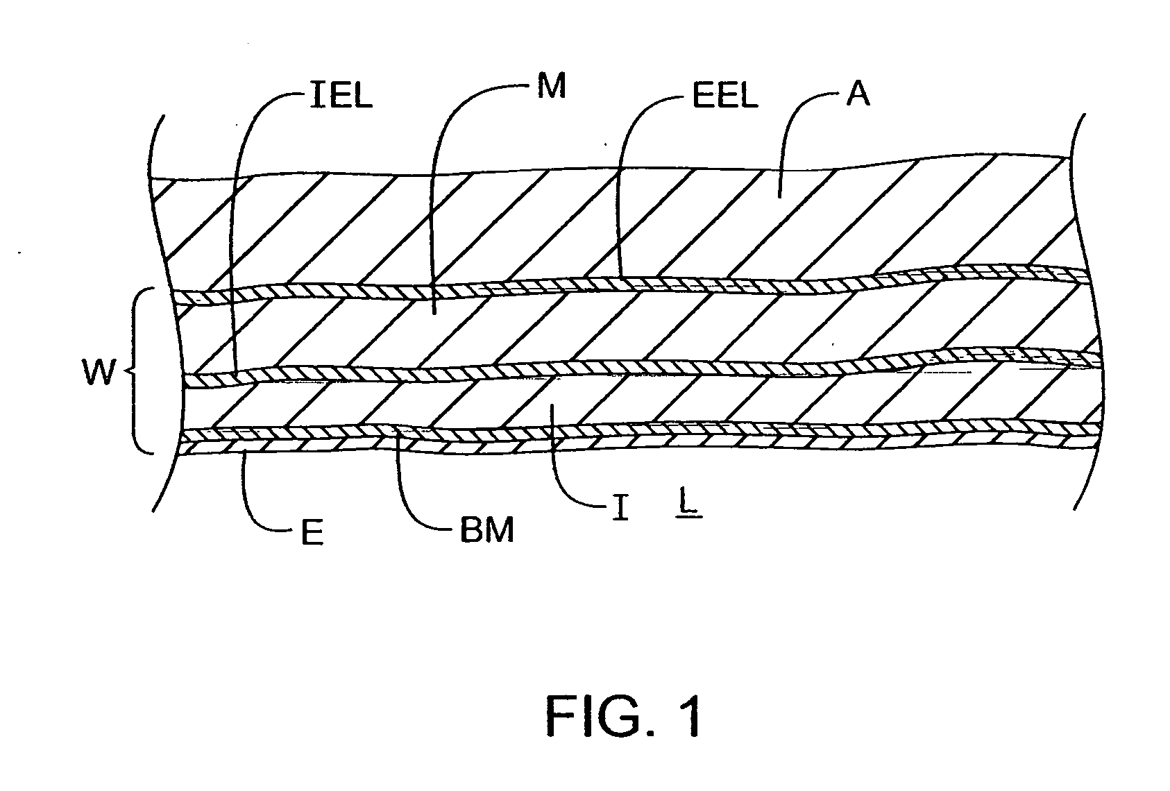 Methods and kits for delivering pharmaceutical agents into the coronary vascular adventitia