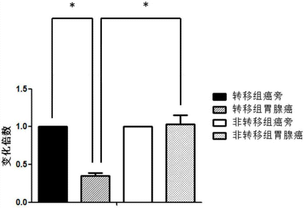 Diagnosis and treatment tool for metastasis of gastric adenocarcinoma