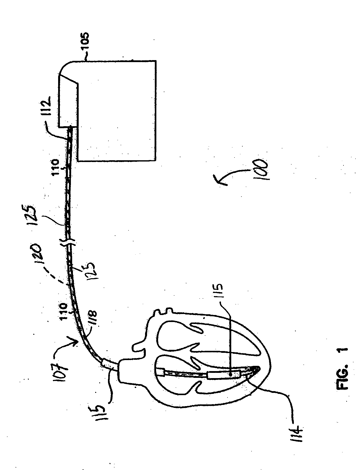 Systems and methods for characterizing leads