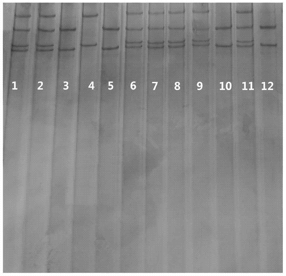 Specific primers and typing method of class I mhc gene for detection of anti-virus potential of Chinese alligator