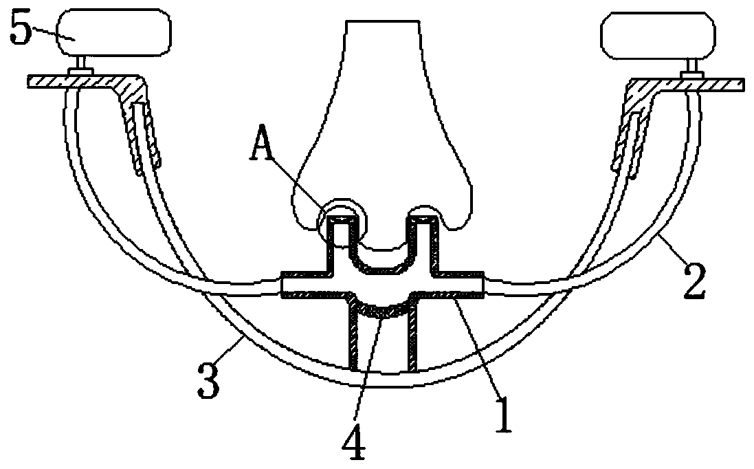 Ear medicine-applying device for otitis media treatment