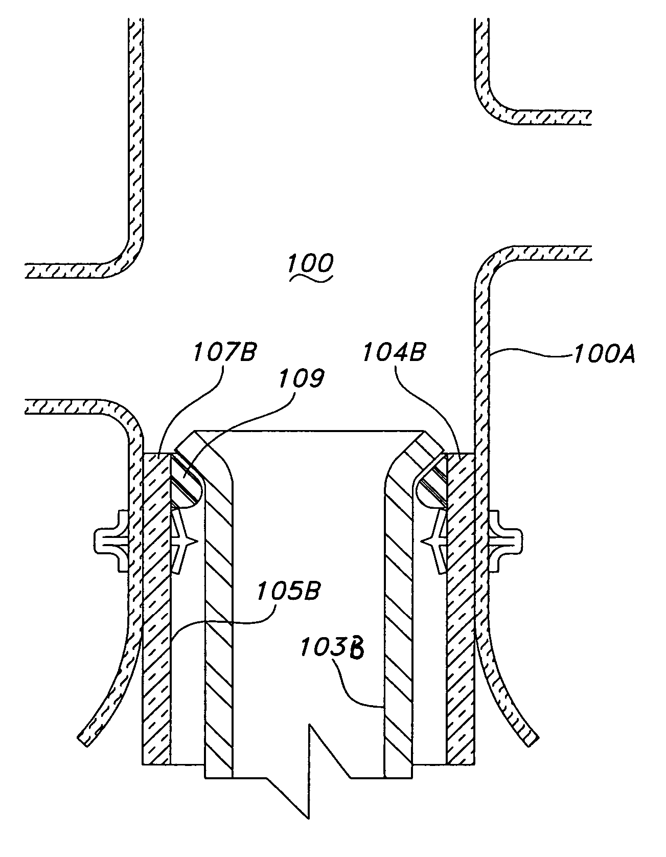 Prosthesis fixation device and method