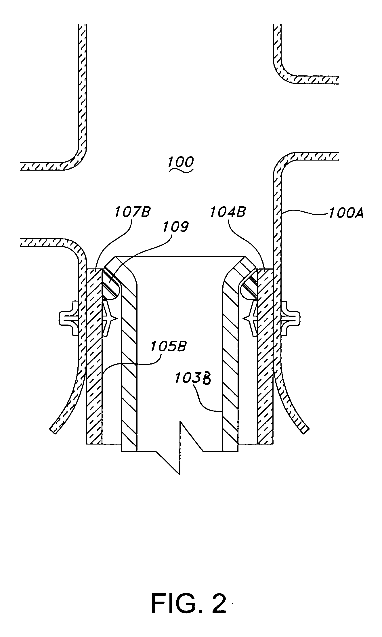 Prosthesis fixation device and method