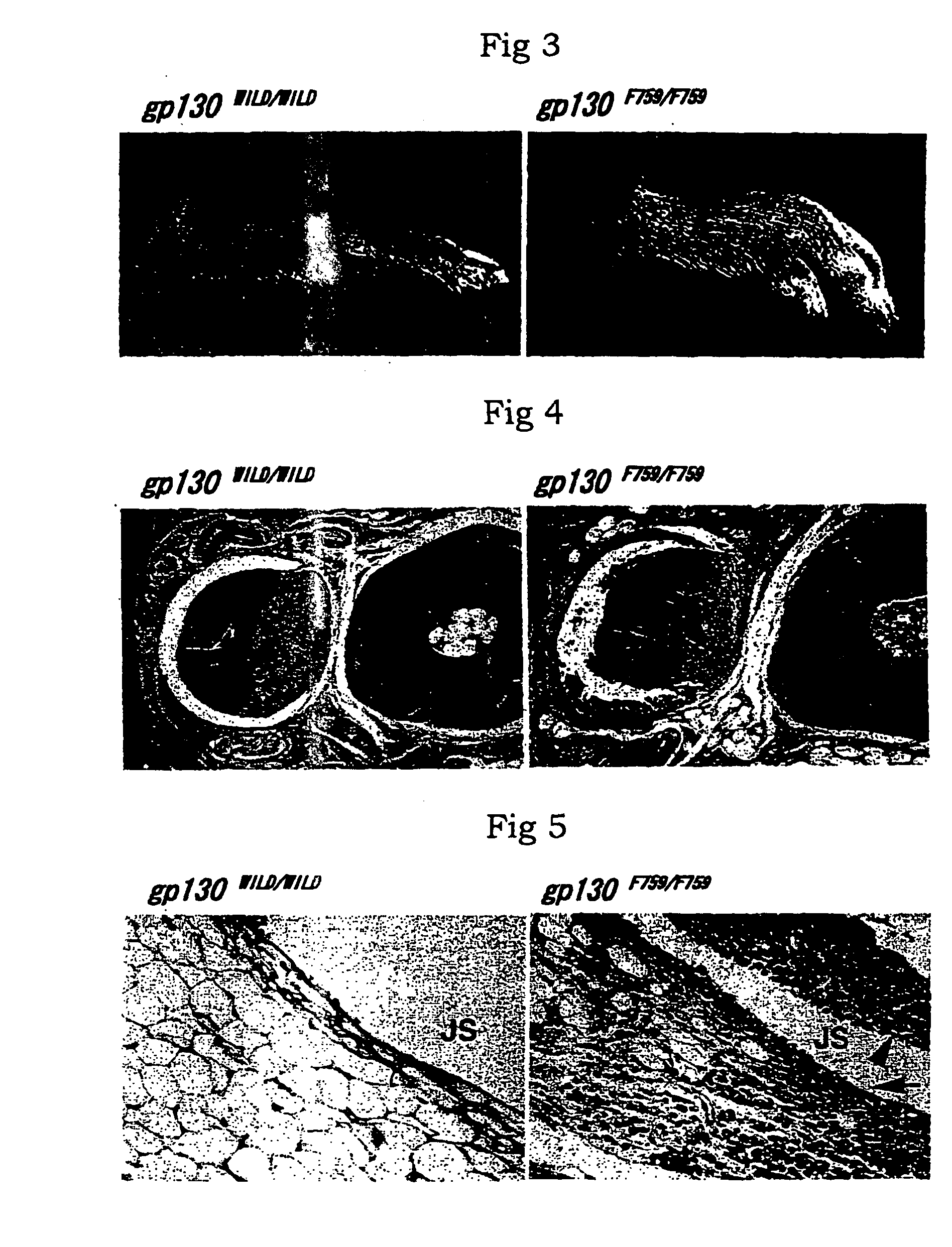 Method of screening for substance preventing or treating diseases in association with malfunction of il-6 family cytokine receptor malfunction