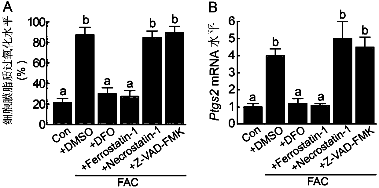 Application of ferroptosis inhibitor in preparation of medicine for treating iron overload disease