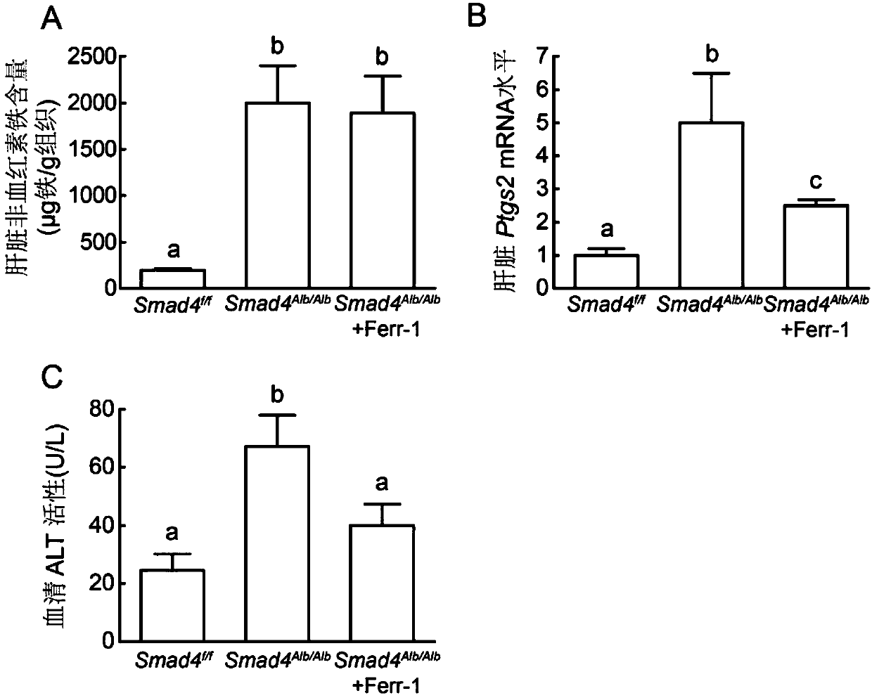 Application of ferroptosis inhibitor in preparation of medicine for treating iron overload disease