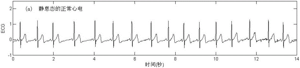Lie detection method based on electrocardio measure
